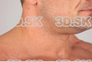 Neck texture of Gene 0003